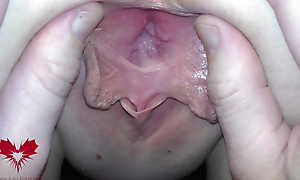 The mistress' vagina is opened with a hole expander so that u can study say no to cervix.