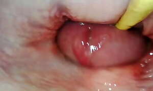 AMAZING INTERNAL POV. CAMERA INSIDE HER PUSSY WHILE I FILL HER WITH CUM